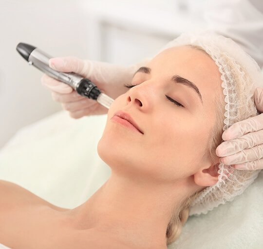 Microneedling_Luminosity-Skincare Woman getting a microneedling facial treatment
